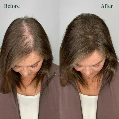 Kerarose Rosemary Shampoo For Hair Growth (Buy 1 Get 1 Free)
