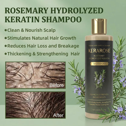 Kerarose Rosemary Shampoo For Hair Growth (Buy 1 Get 1 Free)