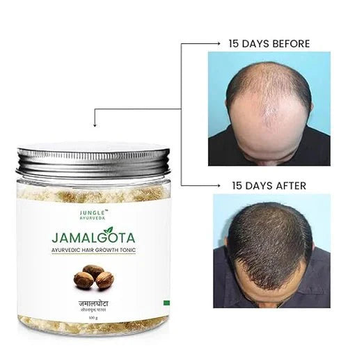 Ayurvedic Hair Growth Powder 🌱✨ (Buy 1 Get 1 Free🔥🔥)